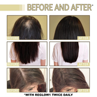 EELHOE HAIR GROWTH OIL